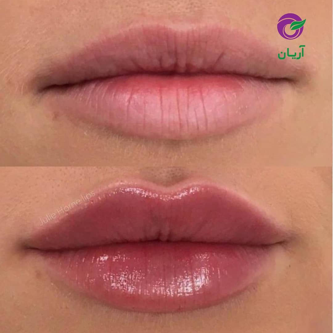 رژلب حجم دهنده و بزرگ کننده لب تا ۲۴ساعت مایع اصل فرانسه--شماره 148 لاکچری کوین